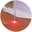 Laserterapia avançada